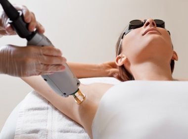 How Safe is Laser Hair Removal?