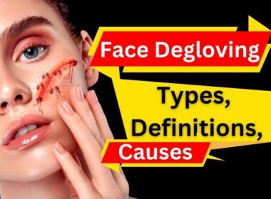 degloved face